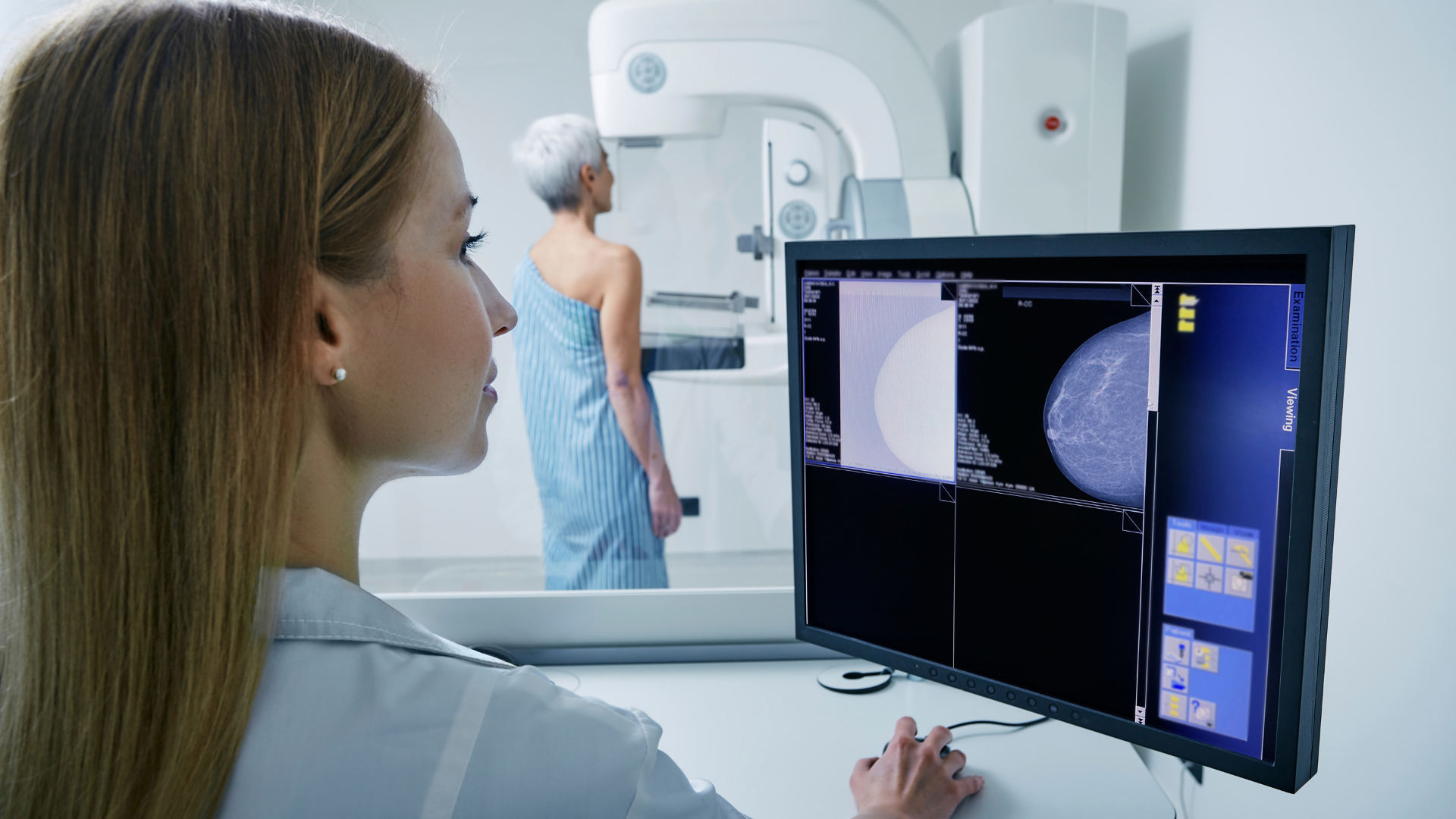 Las mamografías reducen en un 30 por ciento la mortalidad por cáncer de mama 
