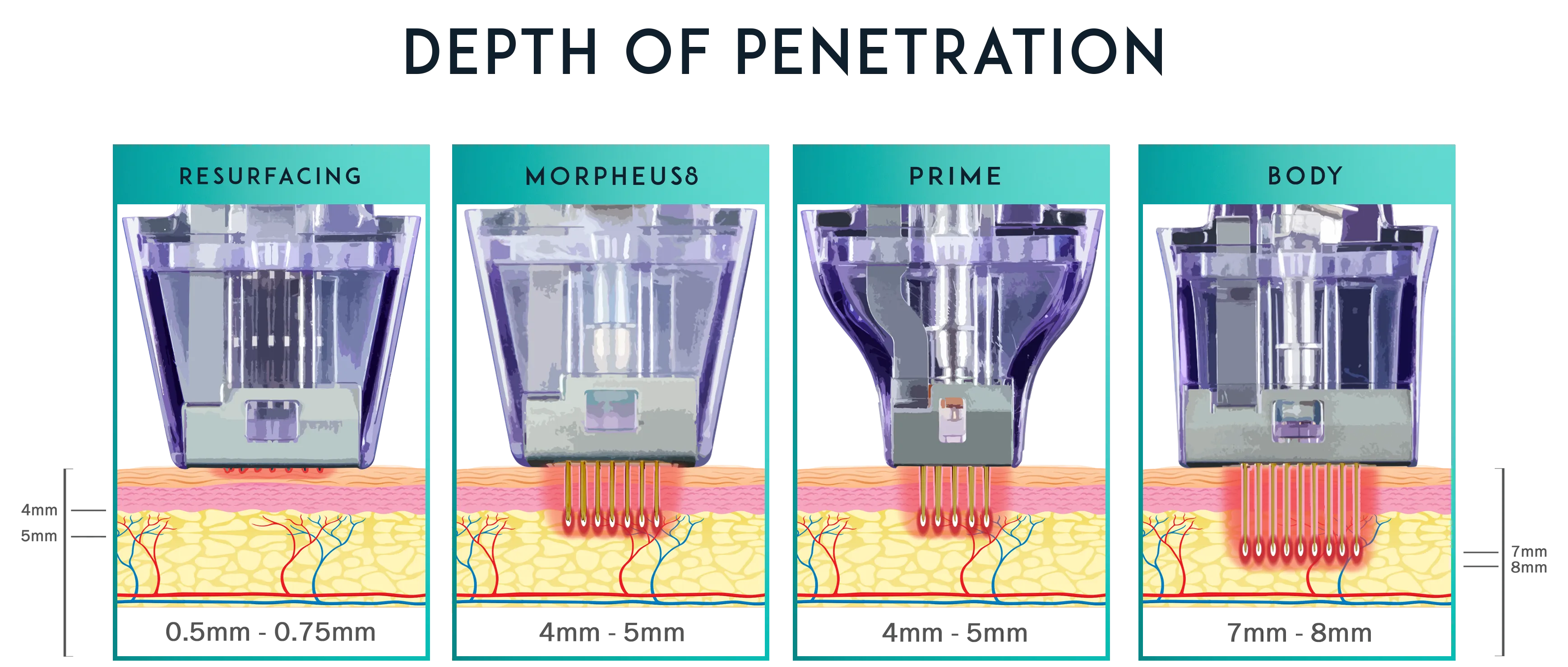 Morpheus8. Depth of Penetration